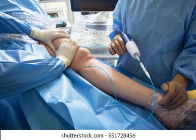 Doctors Doing Vein Surgery Procedure