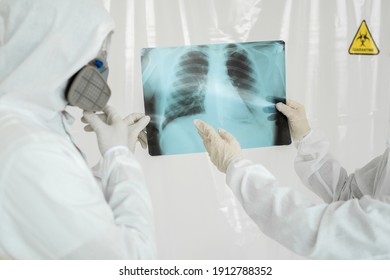 Doctors Epidemiologists examine x-ray for pneumonia of a Covid-19 patient. Coronavirus concept.