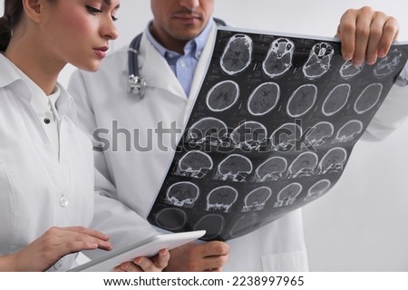 Doctors examining MRI images of patient with multiple sclerosis in clinic, closeup