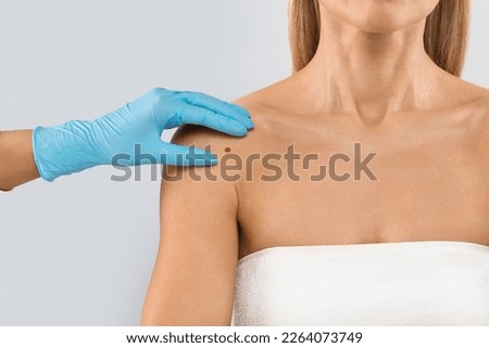 The doctor's gloved hand checking mole nevus on unrecognizable woman's shoulder, isolated on grey studio background. The concept of moles and skin cancer concept, cropped