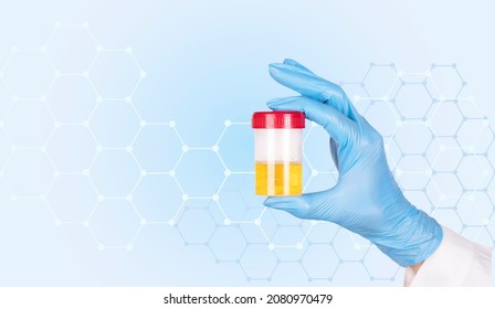 Doctor's hand in a blue glove holding a urine sample, medical urine test in a laboratory on a blue medical background. Copy space. High quality photo