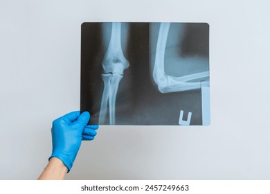 Doctor's hand in glove holds film of radiography. X-ray of a patient - Powered by Shutterstock