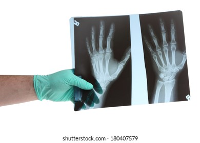 Doctors Hand Holding Xray, Cutout On White Background