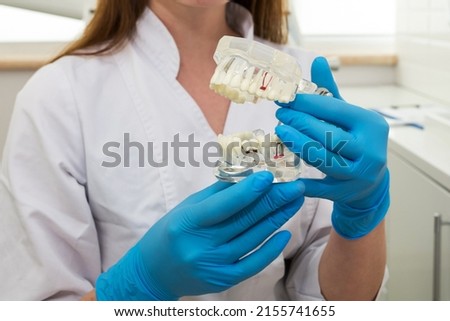 The doctor's hands in blue gloves hold an artificial jaw model close-up. dental care