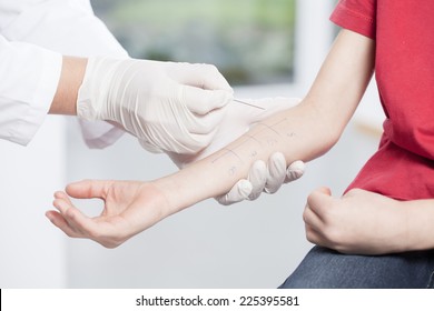 Doctor's hands doing skin prick allergy test - Powered by Shutterstock