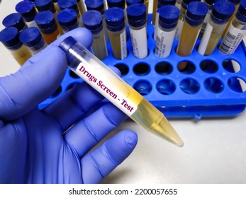 Doctor's Hold Urine Drug Screen Test Sample, Also Known As A Urine Drug Screening Painless Test It Analyzes Your Urine For The Presence Of Certain Illegal Drugs And Prescription Medications