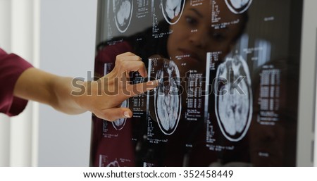 Doctors reviewing brain x-rays