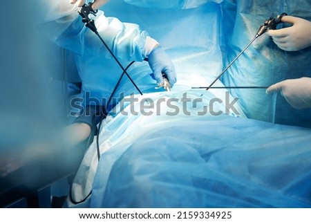 Doctors using laparoscopic camera while performins surgery