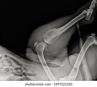 Dog Limb Xray. Canine Bone Tumor Radiography. Dog Tibial Osteosarcoma