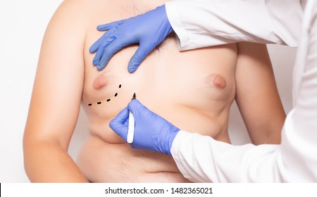 gynekomasti operation gratis gynekomasti operation gratis