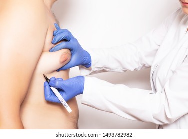 Doktor plastic surgeon preparation before surgery to reduce breasts in men, gynecomastia, liposuction