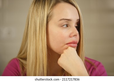 Domestic Abuse Victim Woman With Facial Scars Looking Away. Serious And Stressed Violence Survivor Female With Scar On Face Contemplating. Beautiful Injured Person 