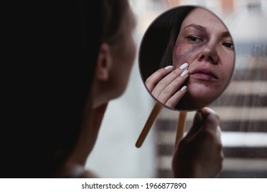 Domestic Violence, Abuse Woman With Bruise On Face On The Window Looks In The Mirror