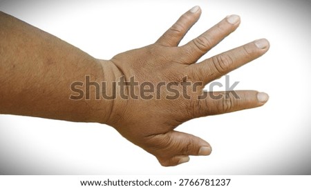 The dorsal view of a human hand and forearm, showcasing skin texture, hair, and a wide finger spread