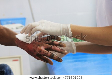 Dressing wound burn of second degree of wrist and hand with blur