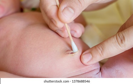 The Dried Stump Of An Umbilical Cord In A Newborn Baby's Belly Button Cleaning.