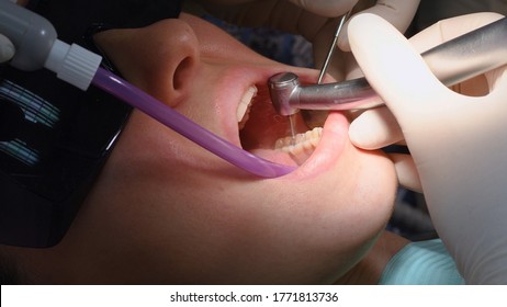 Drilling teeth and sucking saliva with ejector. Young woman at dental clinic. Female dentist with assistant treating cavities in a patient mouth in modern dental office.