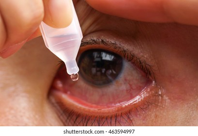 Dripping A Red Eye With Eye Drops Close Up