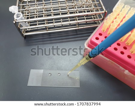 Drop of rabbit plasma by using micropipette for Slide Coagulase Test