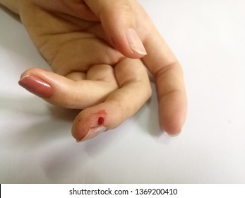 Drops Of Blood At The Fingertips Due To Being Stabbed With A Sewing Needle.