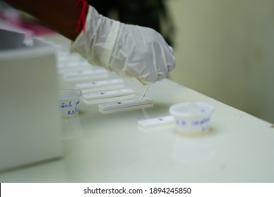 Drug Testing, Drug Testing Kit, 
Police And Administrative Officials Bring Drug Testing Kits To Inspect In Establishments, Schools, And Departments.