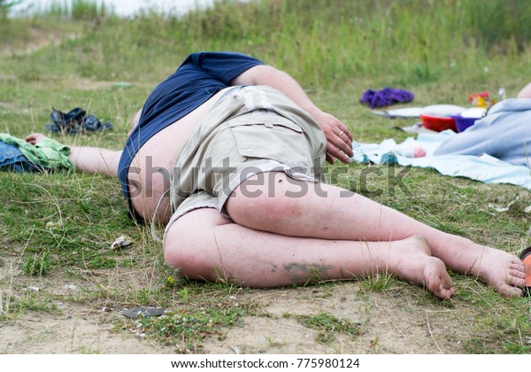 Fat drunk shorts long hair