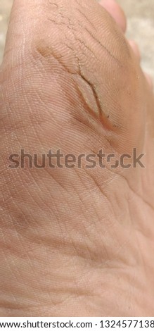 Similar – Image, Stock Photo Resilience, enduring pain, needles from a conifer stuck in your hand