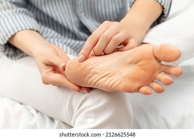 Dry cracked skin of feet and heels. Peeling, cracks and cornea sole of the foot. Dryness, dermatitis, dehydration, eczema, psoriasis, skincare and health concept. - Shutterstock ID 2126625548
