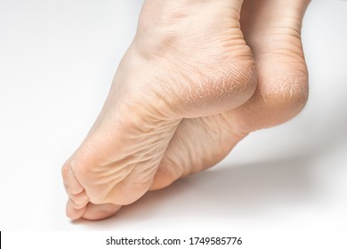 Rough Feet