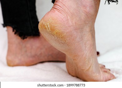Ivory soles feet