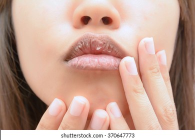  dry mouth - Shutterstock ID 370647773