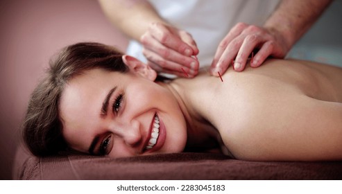 Dry Needle Acupuncture Treatment. Female Medical Spa Therapy