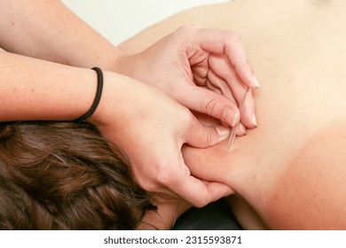 Dry needling of a sore shoulder - Shutterstock ID 2315593871