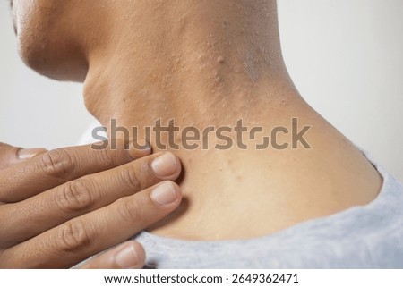 Dry and scaly patch on neck being touched, indicating skin condition like eczema or fungal infection.