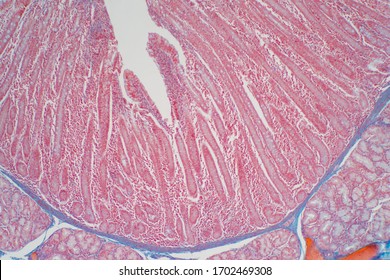 Duodenum Biopsy From The Pathology Of  Small Intestine. Education For Human Histology.