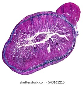 Duodenum Cross Section Micrography In White Back