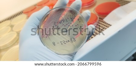 E. Coli colonies, GNR, Gram negative Rods colonies as test on Chomogenic UTI Agar plate, laboratory background