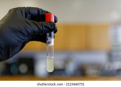 E. Coli Culture In A Test Tube. This Organism Lives In The Intestinal Tract Of Warm-blooded Animals.