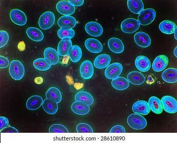 Each reptilian blood cell shows characteristic nucleus.  A few smaller white blood cells are visible. This image has been enhanced to accentuate internal structure.  1000X oil immersion