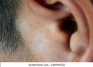 Ear Hole And Wax Ear Of Human