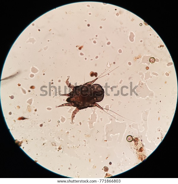 Ear Mite Feline On Light Microscope Stock Photo (Edit Now) 771866803