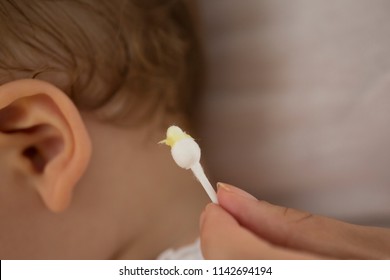 Ear Wax On Cotton Swab.baby Ear