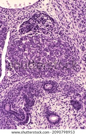 
Early stage in the development of the adrenal gland. Above the kidney outline, is a rounded aggregate of cells (adrenal cortex). Above are small, dark cell cords (sympathoblasts) (adrenal medulla) 
