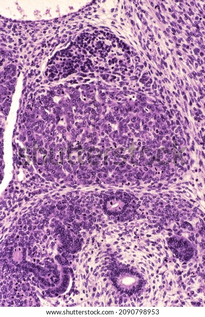 \
Early stage in the development of the adrenal gland.\
Above the kidney outline, is a rounded aggregate of cells (adrenal\
cortex). Above are small, dark cell cords (sympathoblasts) (adrenal\
medulla) 