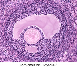 Early tertiary follicle with an antrum well visible. The oocyte, located in a cumulus oophorous is surrounded by zona pellucida and corona radiata. The nucleus of oocyte is in another cut plane.