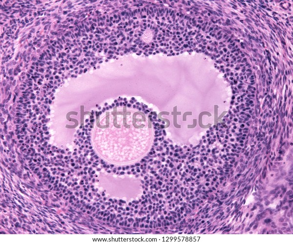 Early Tertiary Follicle Antrum Well Visible Stock Photo Edit Now 1299578857