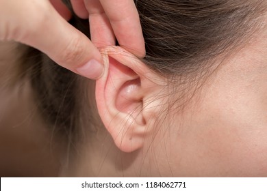 Ears protruding from under the hair, otolaryngologist treatment of diseases in the ears, hearing loss, eavesdropping, Otoplasty plastic surgery, elf ears, lop-eared big-eared