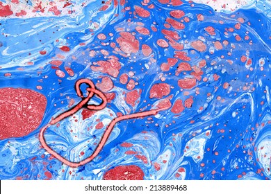 Ebola Virus Seen Under A Microscope With Epidemic Sign