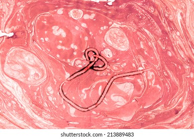 Ebola virus seen under a microscope with epidemic sign
