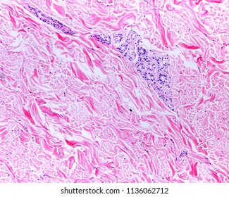 Eccrine Sweat Gland Located In The Dense Irregular Connective Tissue Of Reticular Dermis Of A Thin Skin.